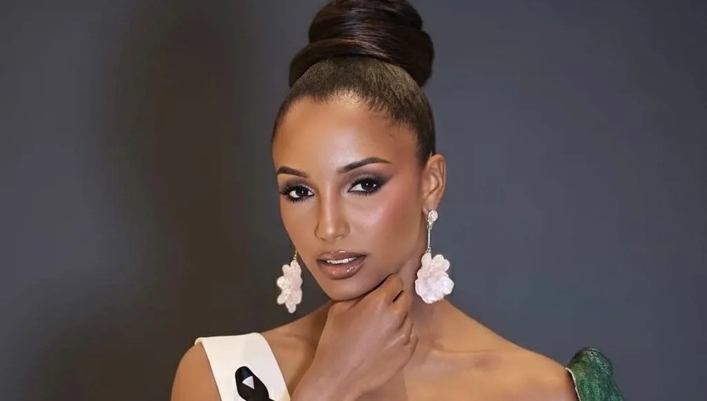 مستجدات الحالةالصحية لملكة جمال جامايكا  بعد سقوطها على المسرح  