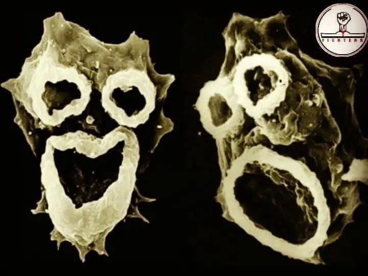 الأميبا آكلة الدماغ 