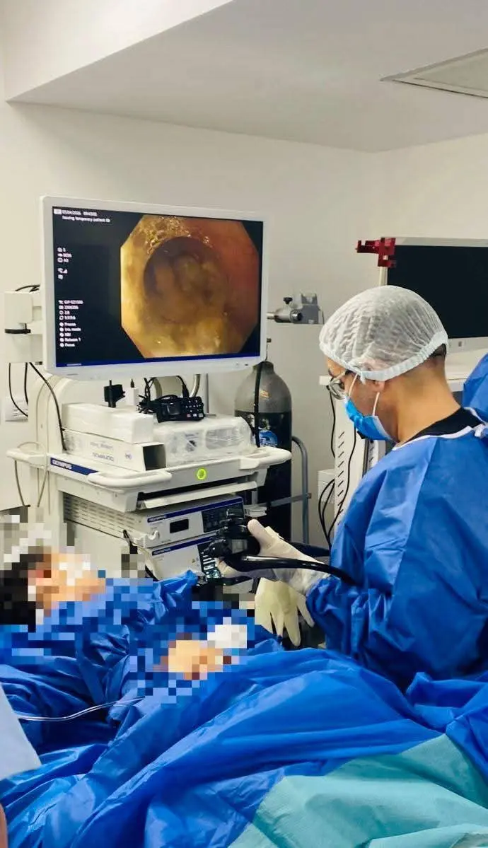 لأول مرة نجاح إجراء تدخل جراحي دقيق باستخدام تقنية شق عضلة المريء بالمنظار (POEM) لطفل يعاني من مرض الأكاليزيا 