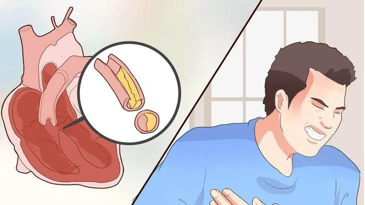 مشكلة ضيق التنفس 