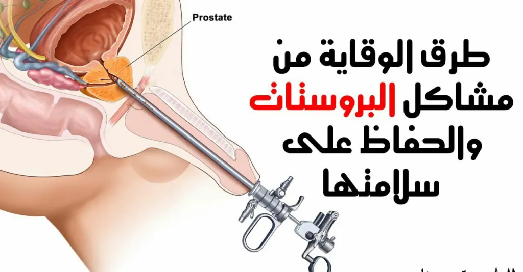 نصائح مهمة للحفاظ على سلامة البروستاتا 
