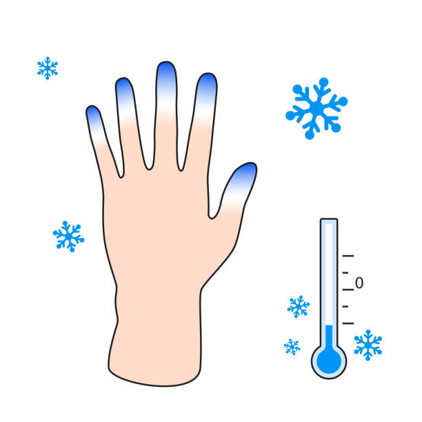 لماذا يحدث تورم للأصابع في فصل  الشتاء؟